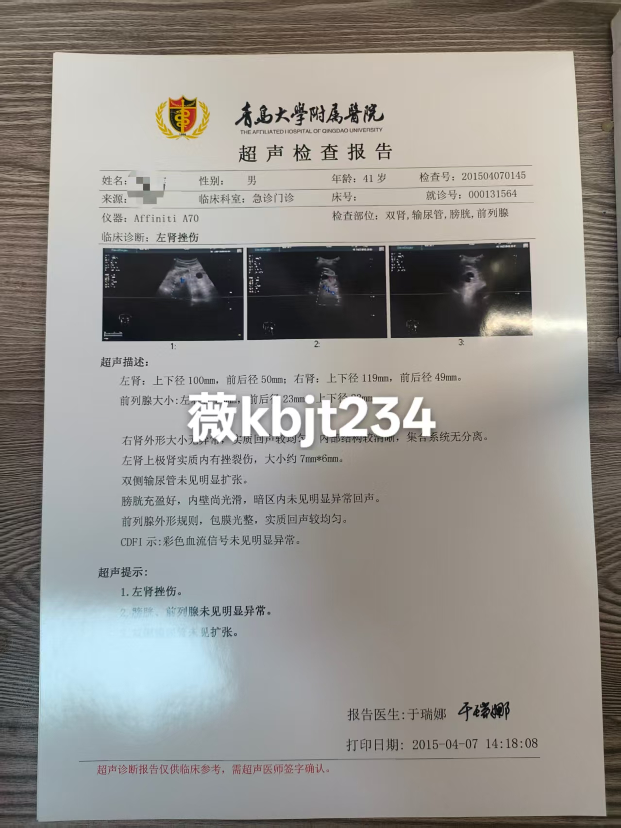 代开医院证明代开b超报告检查报告 代开疾病证明、医院证明、病假条、诊断证明、代开住院证明、住院票据