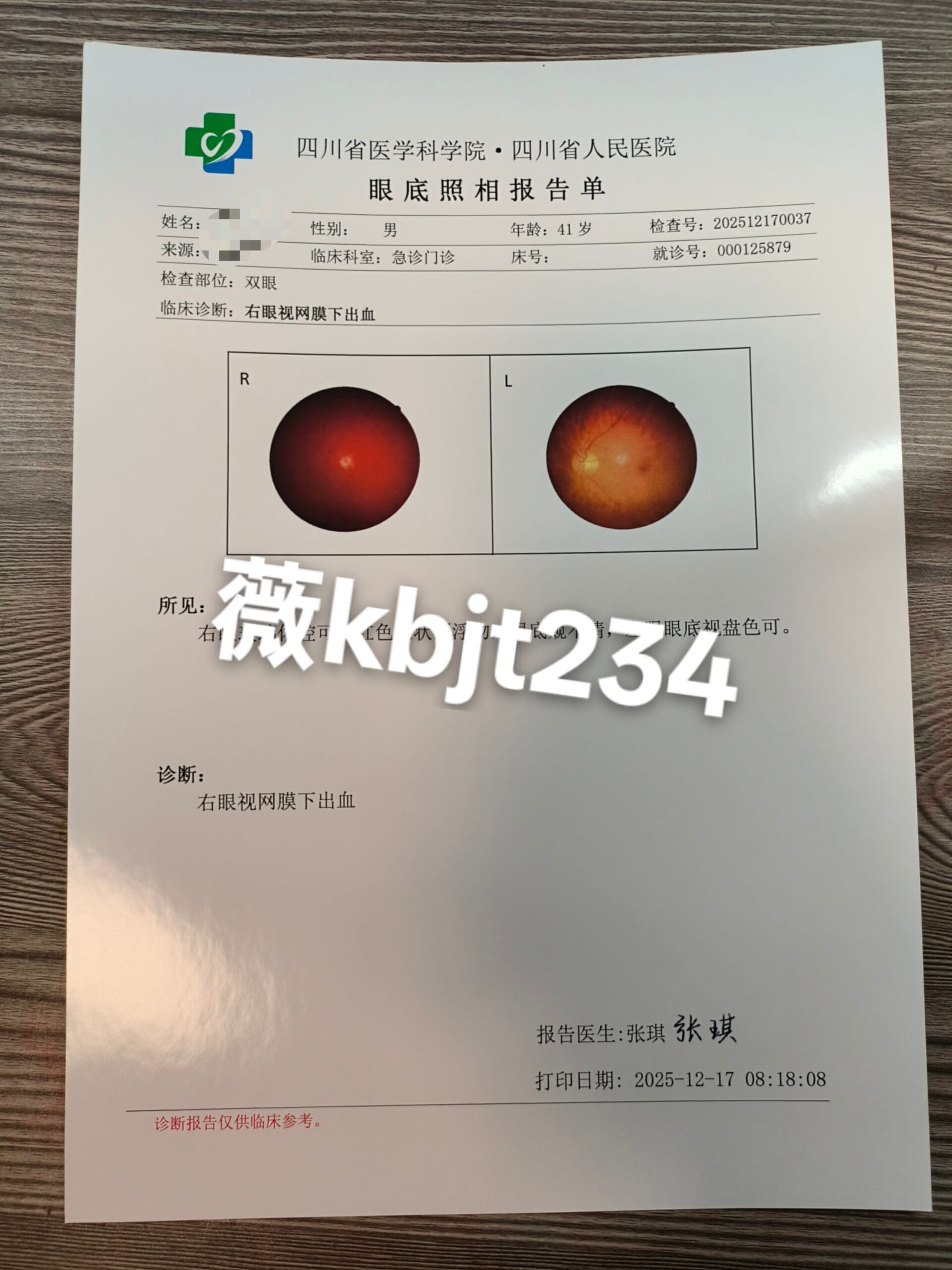 代开眼底照相